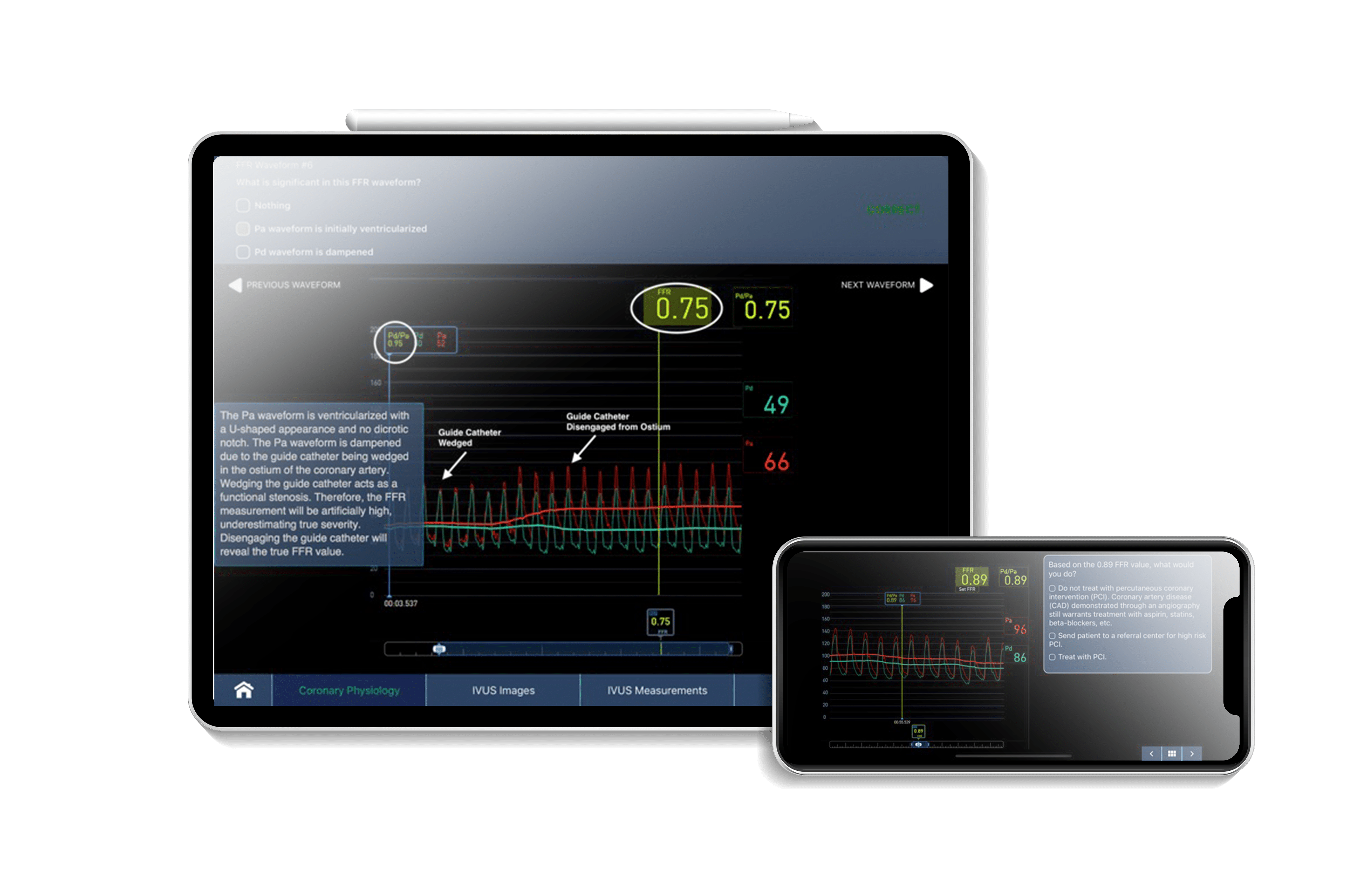 bsc ivus app