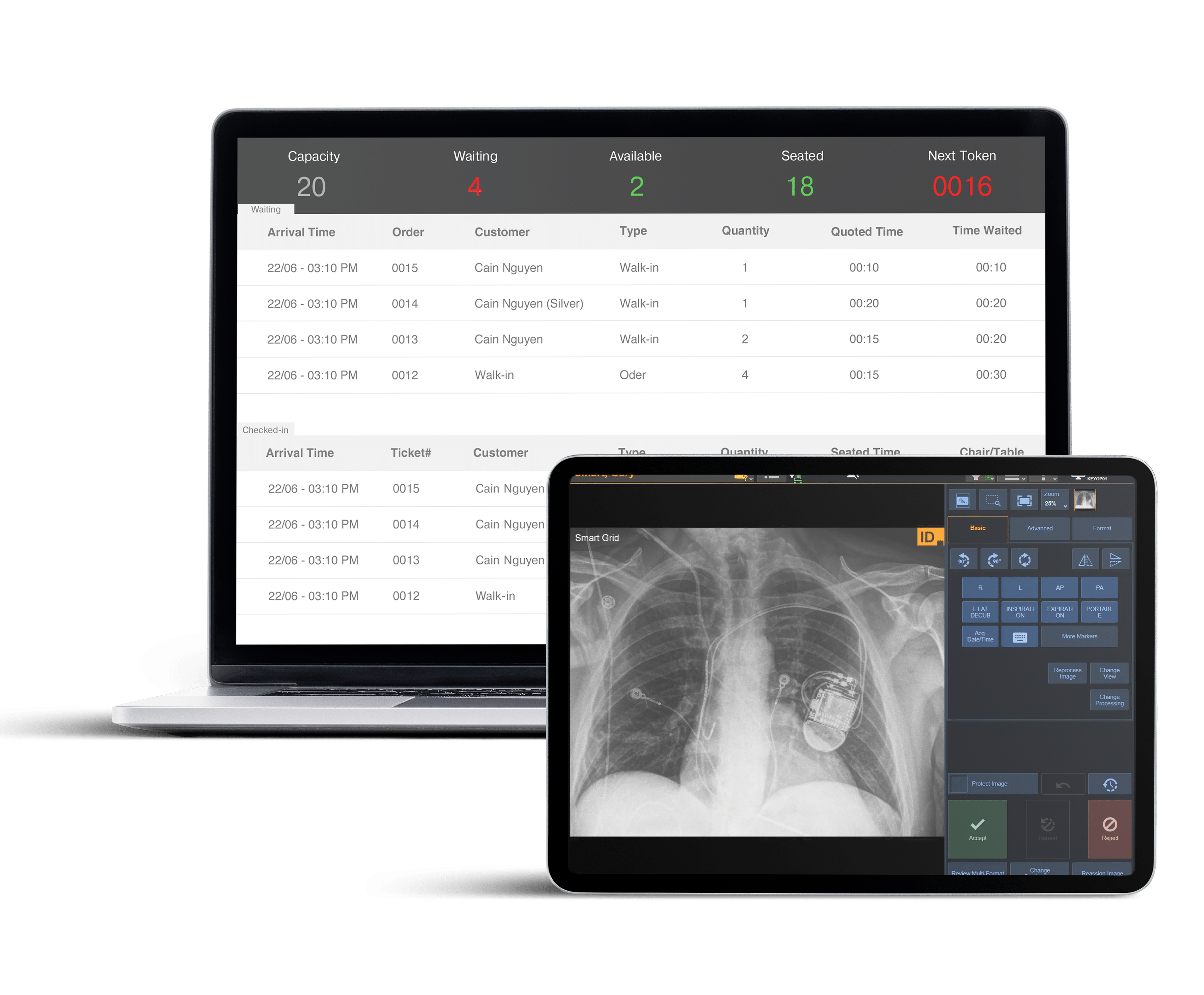 xrayimagingAI