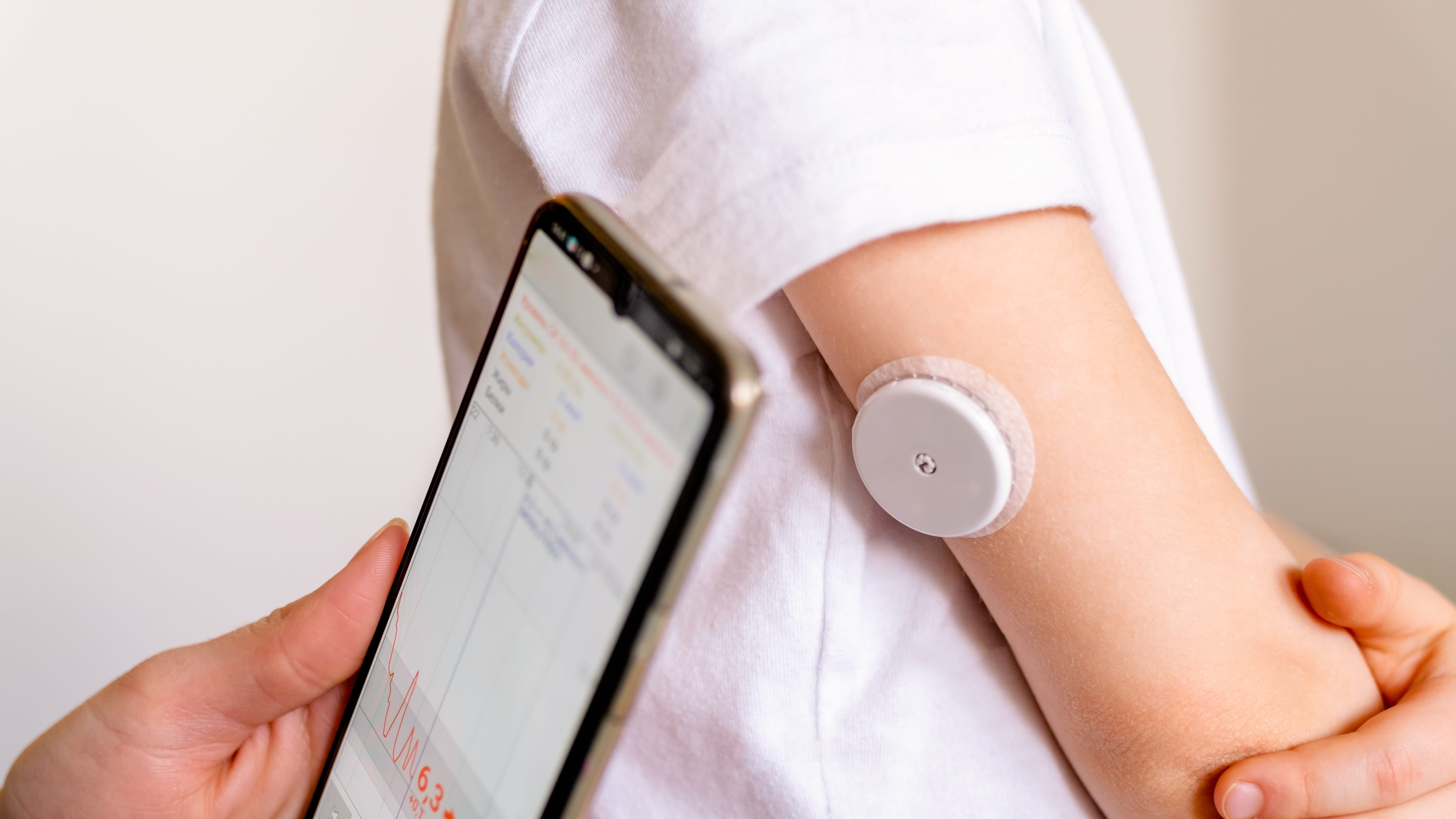 Software as a medical device example connected glucose monitor