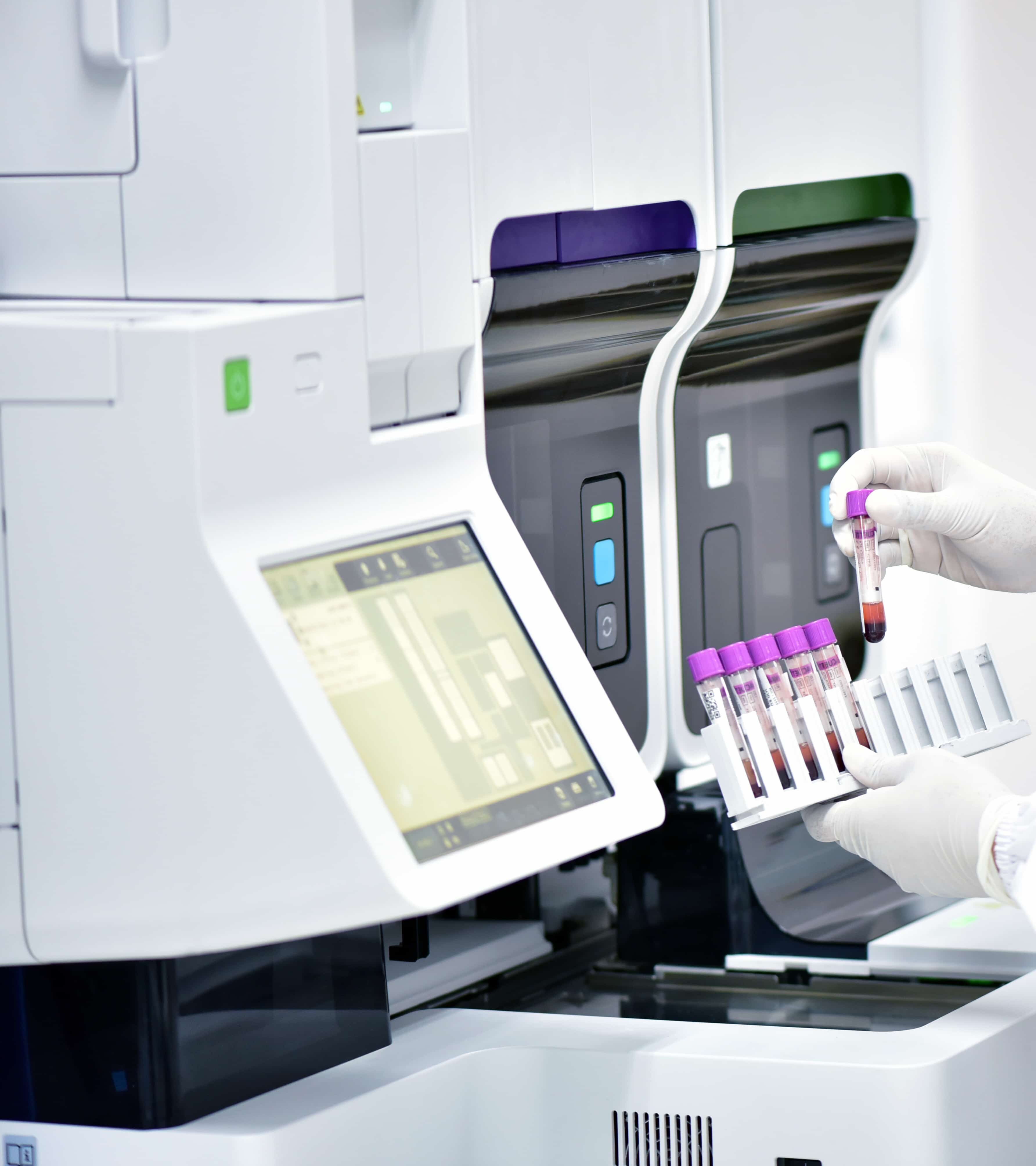 Female medical technologist using diagnostic tools in cancer hos