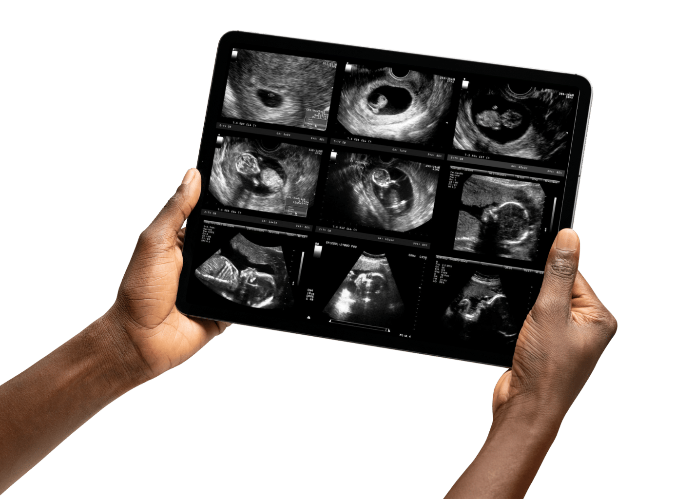 ultrasound-imaging